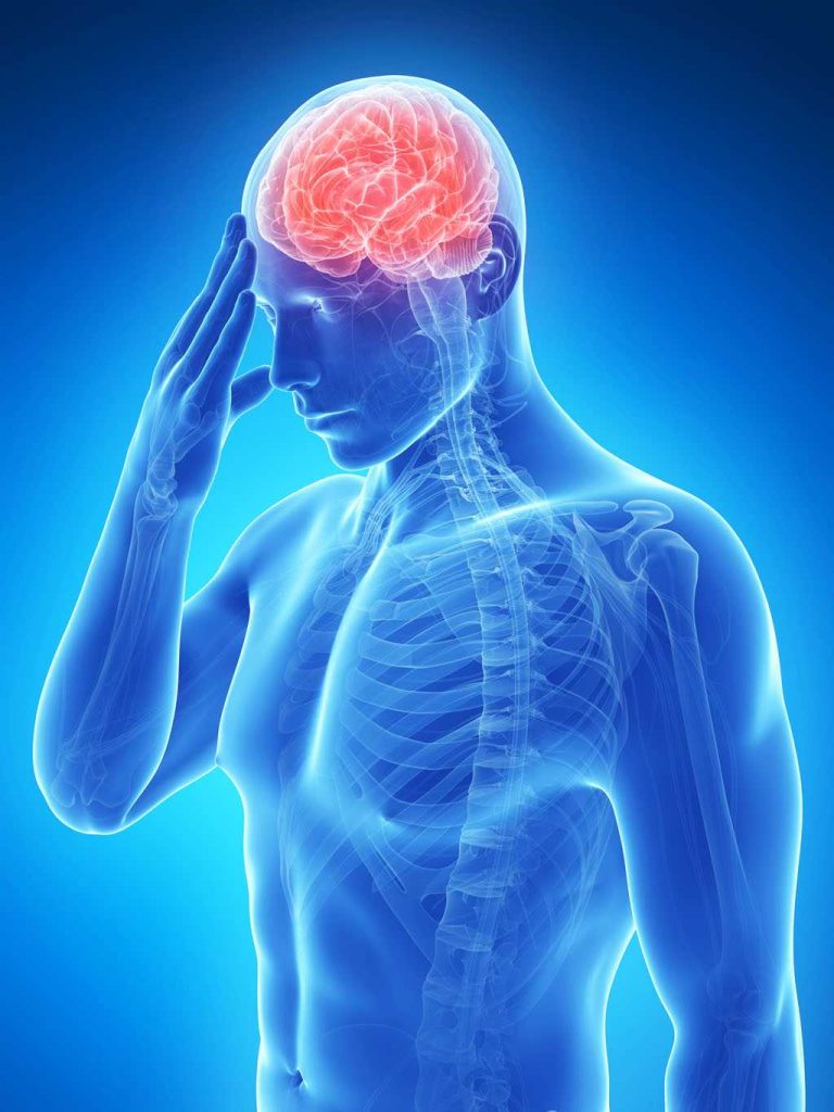 Як запобігти інсульту?